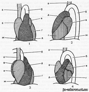 Флюорограмма сердца (схема)